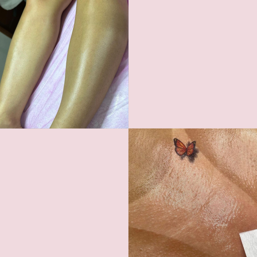 Perna Completa + íntima 